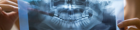 Sample of dental X-ray
