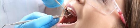 Periodontal treatment dental check-up