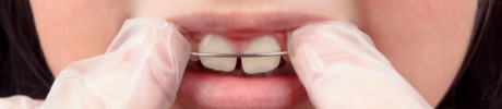 Child wearing orthodontic appliances