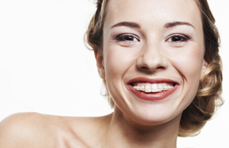 Young woman smiling with dental braces