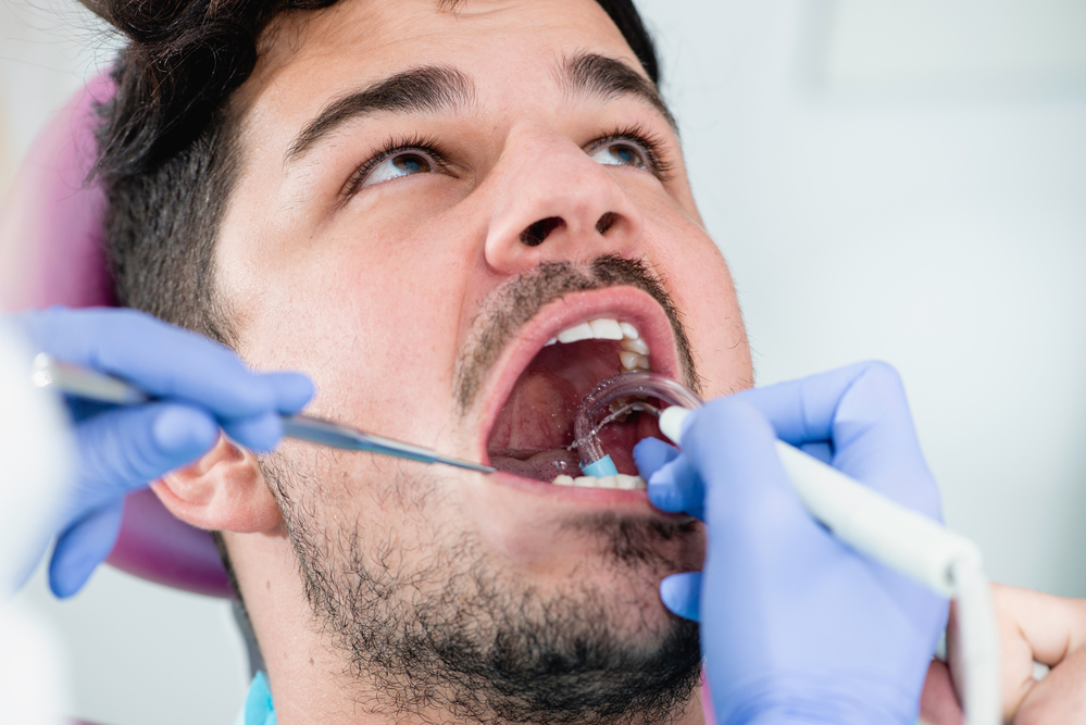Young man having teeth professionally cleaned