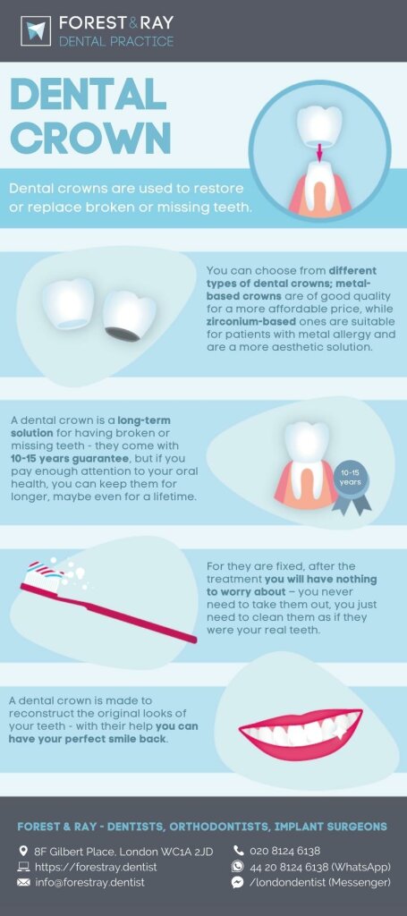 Dental Crowns in Central London | Forest & Ray - Dentists ...