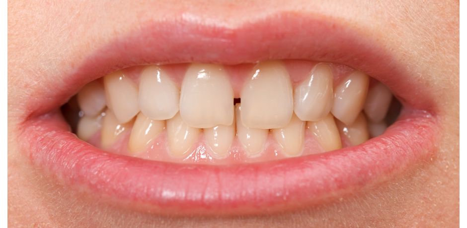𝐃𝐢𝐚𝐬𝐭𝐞𝐦𝐚 🦷 𝐅𝐨𝐫𝐞𝐬𝐭 & 𝐑𝐚𝐲 😊 𝐃𝐞𝐧𝐭𝐢𝐬𝐭𝐬, 𝐎𝐫𝐭𝐡𝐨𝐝𝐨𝐧𝐭𝐢𝐬𝐭𝐬, 𝐈𝐦𝐩𝐥𝐚𝐧𝐭 𝐒𝐮𝐫𝐠𝐞𝐨𝐧𝐬