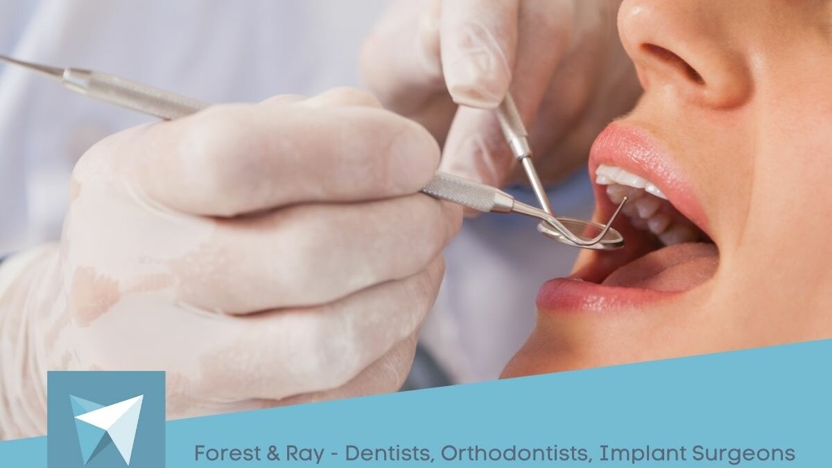 Tooth Fillings in Central London  Forest & Ray - Dentists, Orthodontists,  Implant Surgeons