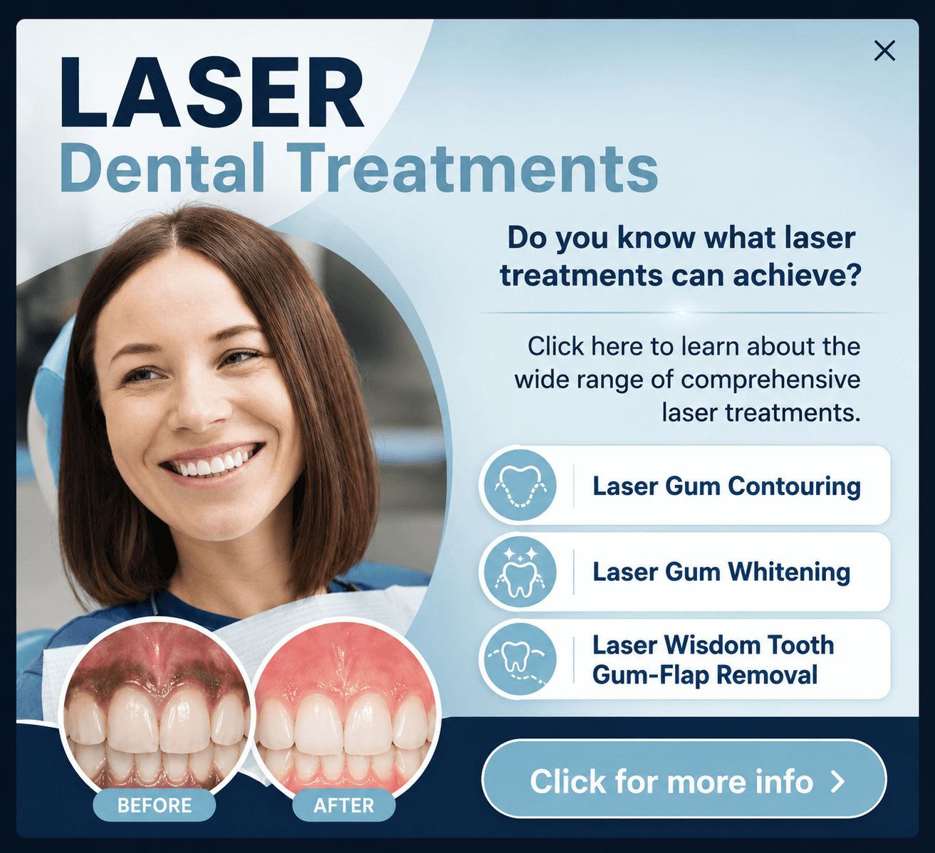laser treatments popup (1) (1)