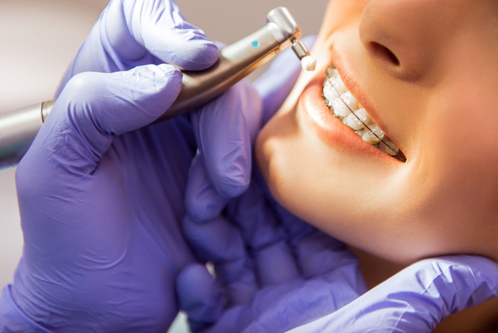 Young Woman with sapphire braces at the dentist