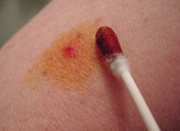 antiseptic